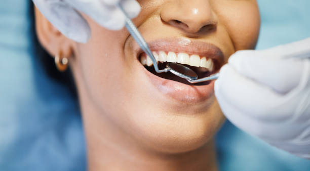 Best Teeth Whitening  in Kings Park, VA